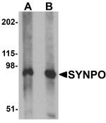SYNPO Antibody in Western Blot (WB)