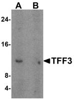 TFF3 Antibody in Western Blot (WB)