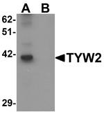 TRMT12 Antibody in Western Blot (WB)