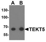 TEKT5 Antibody in Western Blot (WB)