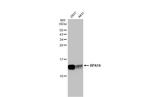 RPA14 Antibody in Western Blot (WB)