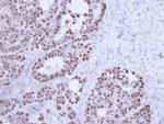 TAP Antibody in Immunohistochemistry (Paraffin) (IHC (P))
