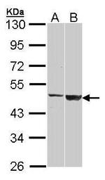 GAL3ST1 Antibody in Western Blot (WB)