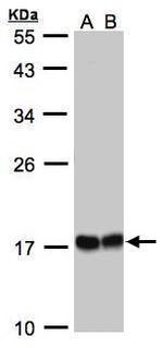 HSPB8 Antibody in Western Blot (WB)