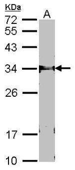 FBXL12 Antibody in Western Blot (WB)