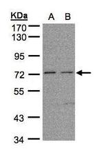 FLRT1 Antibody in Western Blot (WB)