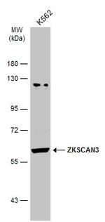 ZNF306 Antibody in Western Blot (WB)