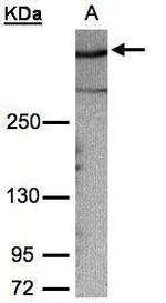 AKAP12 Antibody in Western Blot (WB)