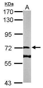DENND1B Antibody in Western Blot (WB)