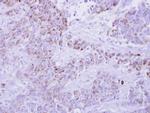 CCL1 Antibody in Immunohistochemistry (Paraffin) (IHC (P))