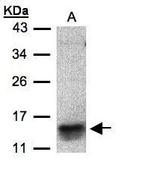 CCL1 Antibody in Western Blot (WB)