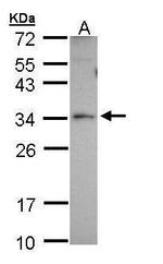 PEX26 Antibody in Western Blot (WB)