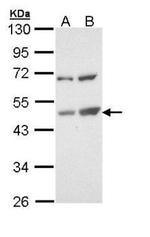 TSPYL1 Antibody in Western Blot (WB)