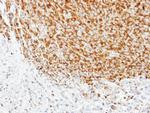 TUBA1A Antibody in Immunohistochemistry (Paraffin) (IHC (P))