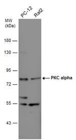 PKC alpha Antibody in Western Blot (WB)
