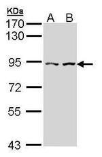 CTNNAL1 Antibody in Western Blot (WB)
