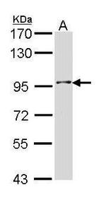 INPP5B Antibody in Western Blot (WB)