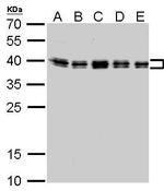 hnRNP C Antibody in Western Blot (WB)