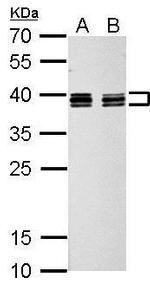 hnRNP C Antibody in Western Blot (WB)