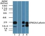 EPM2A Antibody in Western Blot (WB)
