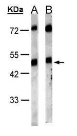 GRPR Antibody in Western Blot (WB)