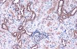 ACSL4 Antibody in Immunohistochemistry (Paraffin) (IHC (P))