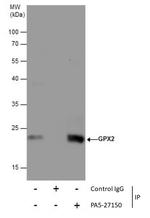 GPX2 Antibody in Immunoprecipitation (IP)