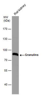 Granulins Antibody in Western Blot (WB)