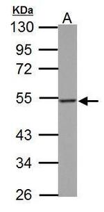 Thymidine Phosphorylase Antibody in Western Blot (WB)