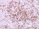 CD40 Antibody in Immunohistochemistry (Paraffin) (IHC (P))