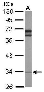 RPL5 Antibody in Western Blot (WB)