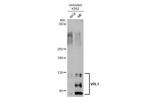 TRPV2 Antibody in Western Blot (WB)
