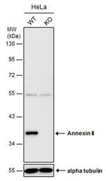 Annexin A2 Antibody