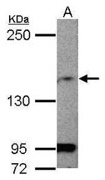 MAGI1 Antibody in Western Blot (WB)