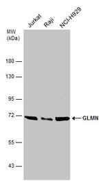 GLMN Antibody in Western Blot (WB)