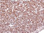GRP94 Antibody in Immunohistochemistry (Paraffin) (IHC (P))