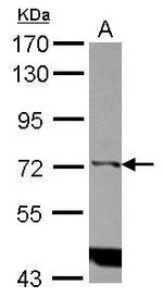 ITPKC Antibody in Western Blot (WB)