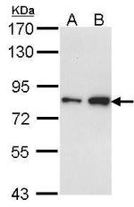 FCP1 Antibody in Western Blot (WB)