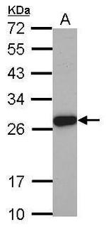 ELA3A Antibody in Western Blot (WB)