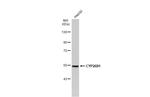 CYP26B1 Antibody in Western Blot (WB)