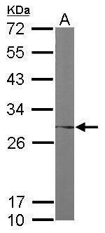 FKBP25 Antibody in Western Blot (WB)