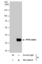 PP2A alpha Antibody in Immunoprecipitation (IP)