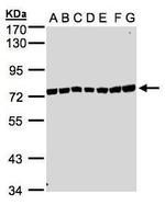 KIAA1530 Antibody in Western Blot (WB)