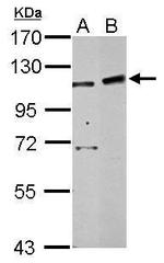 PHF16 Antibody in Western Blot (WB)