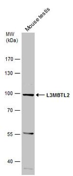 L3MBTL2 Antibody in Western Blot (WB)