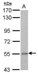 KRT71 Antibody in Western Blot (WB)