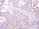 MST3 Antibody in Immunohistochemistry (Paraffin) (IHC (P))