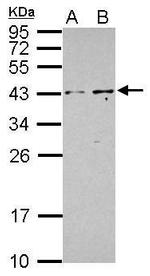 PIP5KL1 Antibody in Western Blot (WB)