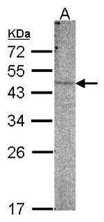 PI4K2B Antibody in Western Blot (WB)