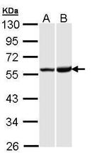 OPRK1 Antibody in Western Blot (WB)